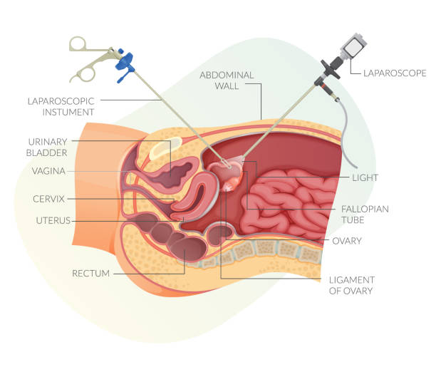 Best Laparoscopic Gynaec Surgery in Ghatkopar